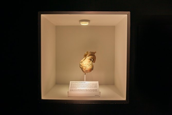 Bodies The Exhibition at the Luxor Hotel and Casino - Exploring the Private Room with Preserved Fetuses